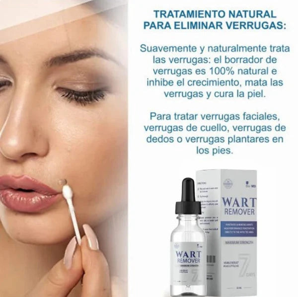 Wart Remover - Removedor de verrugas y lunares