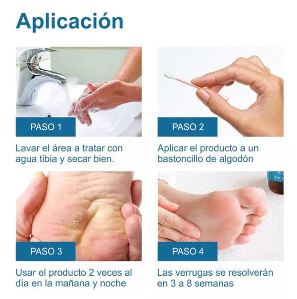 Wart Remover - Removedor de verrugas y lunares