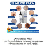 Wart Remover - Removedor de verrugas y lunares